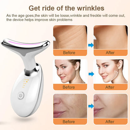 Neck Face Beauty Device EMS Neck Face Lifting Massager Skin Tighten Device LED Photon Therapy Anti Wrinkle Double Chin Remover - TaMNz